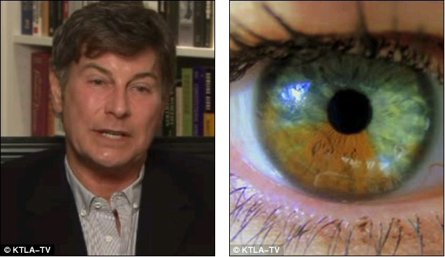 Laguna-olhos-Heterochromia-Eye