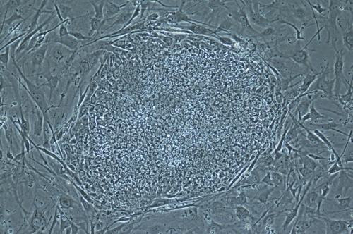 Colônia de células-tronco embrionárias cultivadas na experiência