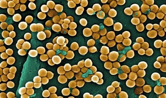 staphylococcus-aureus