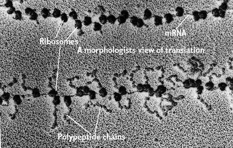 Ribossomos e mRNA vistos em microscopia eletrônica. (Crédito: Bioinfo Pakistan)