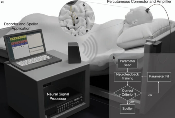 Diagrama da interface cérebro/máquina (Crédito: Crédito: Wyss Center for Bio and Neuroengineering/Nature Communications)
