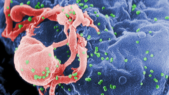 Linfócito infectado liberando vírions (em verde) do HIV-1 (Crédito: C. Goldsmith/CDC's Public Health Image Library (PHIL)/ID #1197/domínio público)