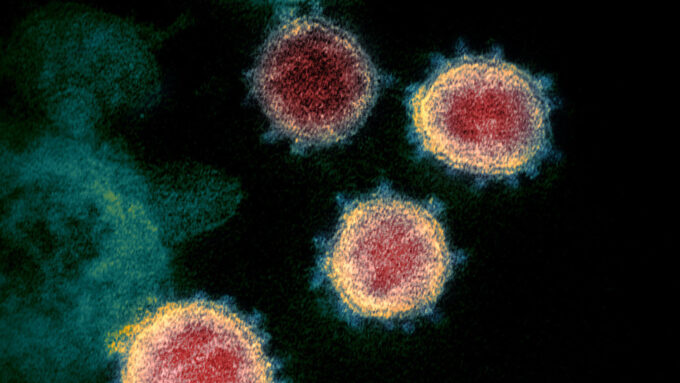 Vírus SARS-CoV-2, que causam a Covid, vistos por um microscópio eletrônico (Crédito: National Institute of Allergy and Infectious Diseases/Rocky Mountain Laboratories)