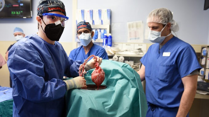 Cirurgiões exibem coração suíno antes dele ser implantado em David Bennett, o primeiro transplantado, que faleceu dois meses depois (Crédito: University of Maryland School of Medicine)