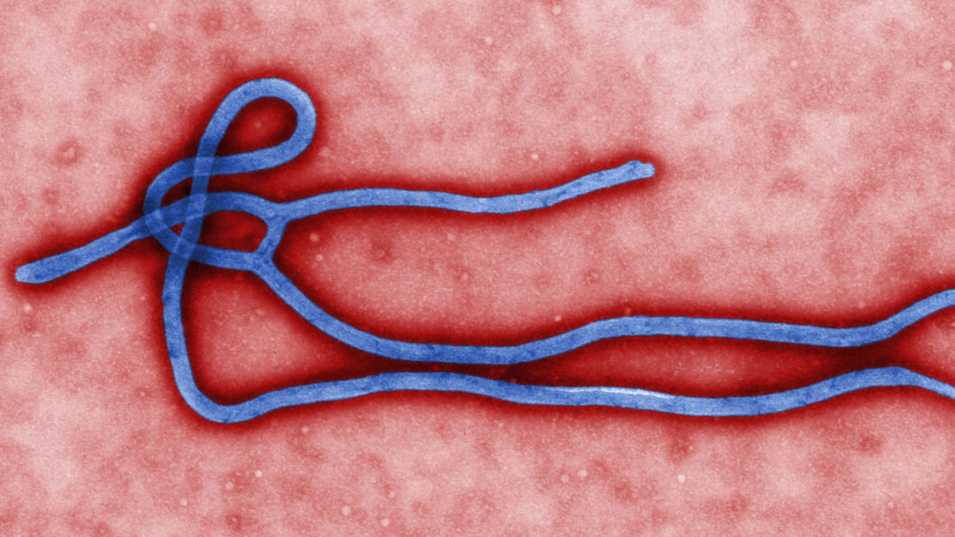 Microfotografía de um vírion (partícula inerte e infecciosa) do vírus Ebola (Crédito: Cynthia Goldsmith/U.S. Centers for Disease Control and Prevention)